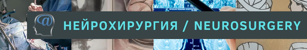 Нейрохирургия