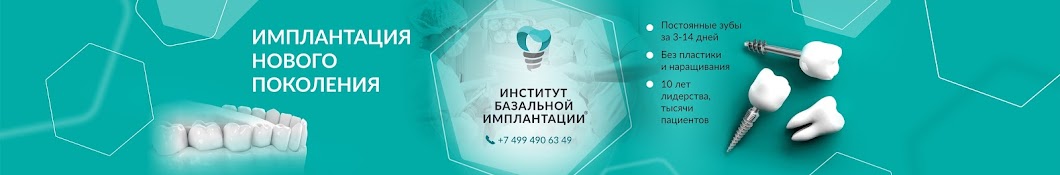 Институт Базальной Имплантации