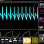 Masimo Waveform