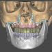 Diseño Dental CADCAM