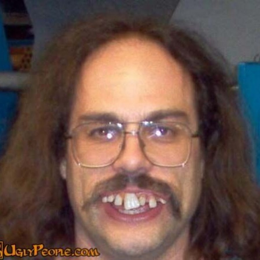 guy with ugly teeth        <h3 class=
