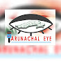 Arunachal Eye