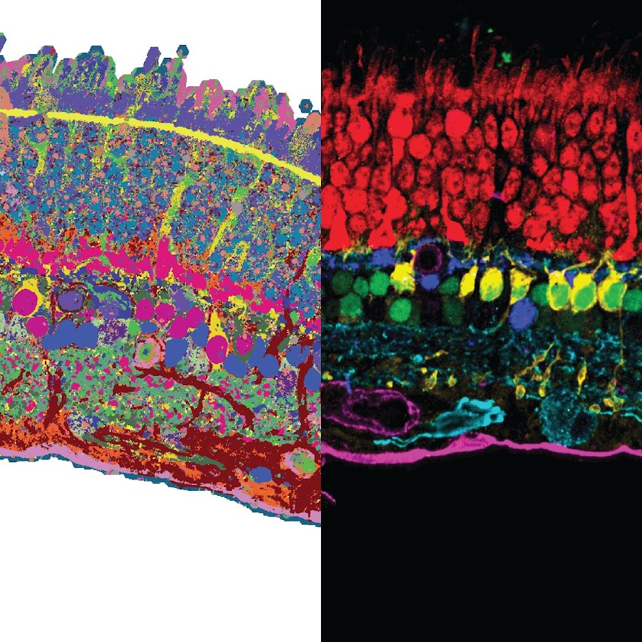 Multimodal spatiotemporal phenotyping of human retinal organoid