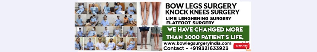 BOW LEG SURGERY INDIA