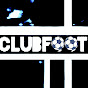 Clubfoot.22