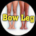 BOW LEG SURGERY INDIA