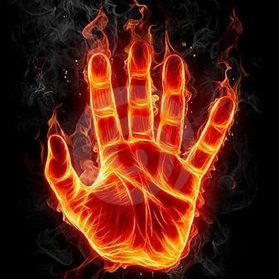 Hand burnt by steam фото 20