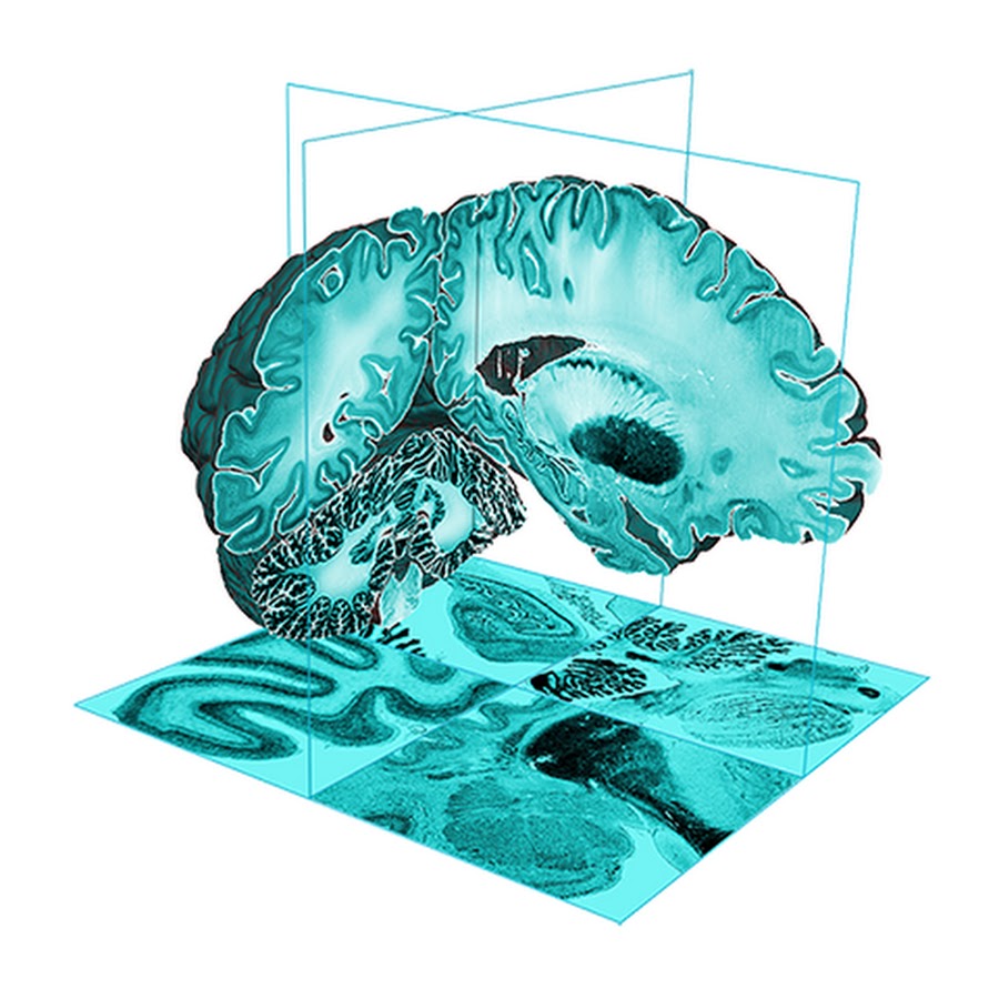 BigBrain: An Ultrahigh-Resolution 3D Human Brain Model