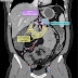 Learn Abdominal Radiology