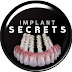 logo IMPLANT SECRETS