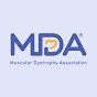 MDA