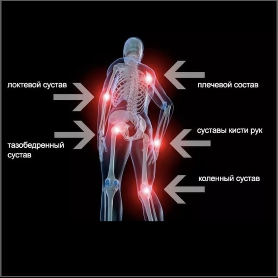 Причины заболевания суставов лечение