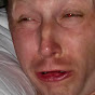 Limmy