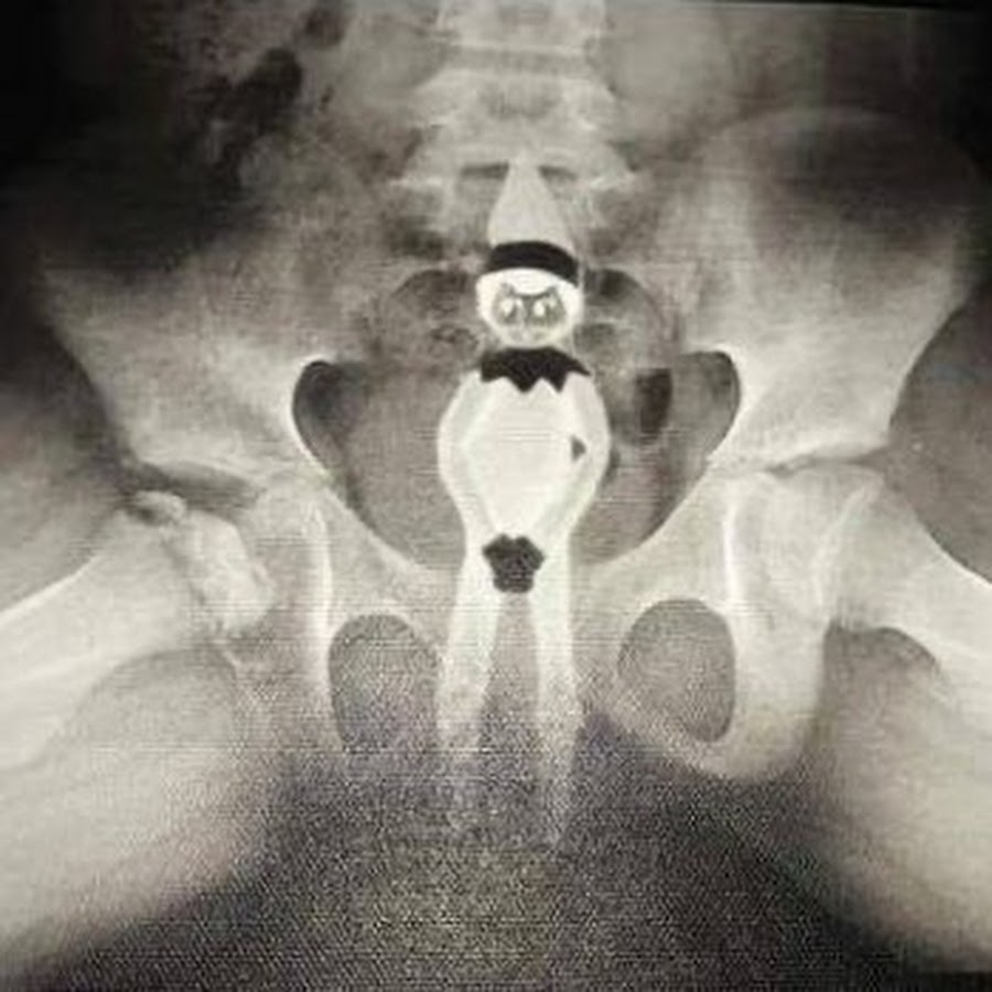 Рентгеновский снимок прикол