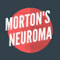 Beating Morton's Neuroma