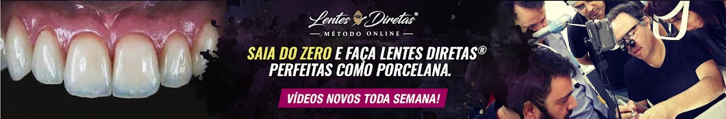 Lentes Diretas