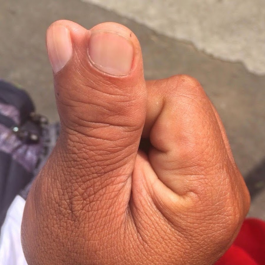 Палец толстый и большой
