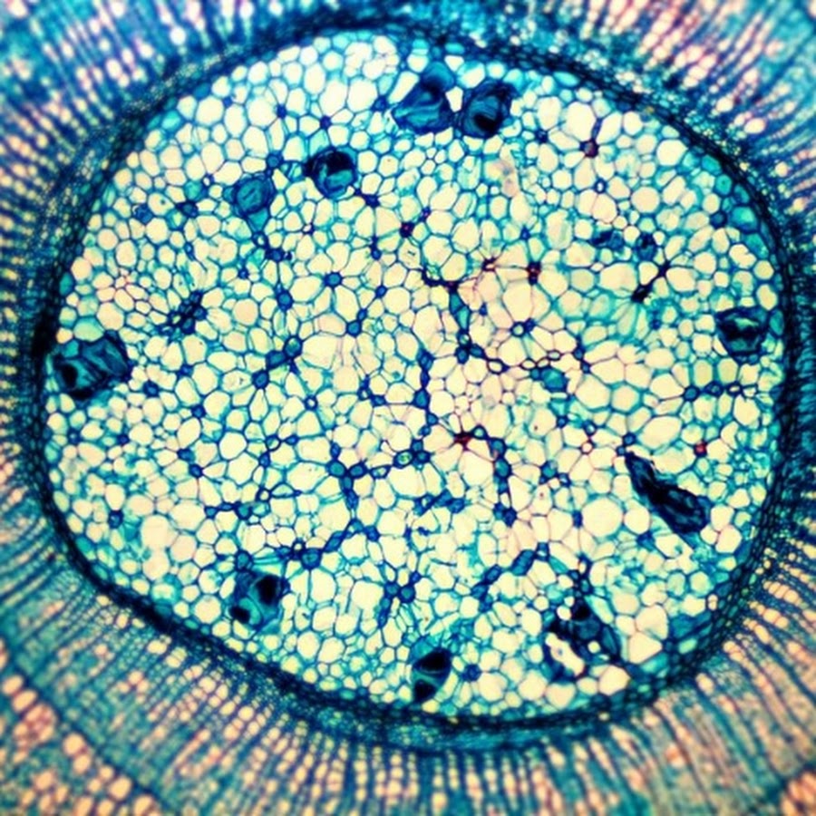 Микро клеток. Микропрепарат животной клетки под микроскопом. Микрофотографии светового микроскопа. Микрофотографии тканей растений. Срез растительной клетки микрофотография.