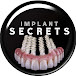 IMPLANT SECRETS