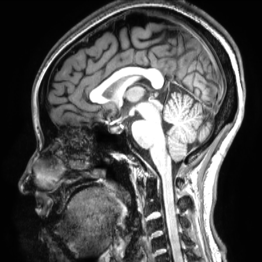 Ali's Radiological Anatomy Course 