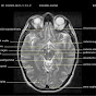 Postgrado Radiología UNAH