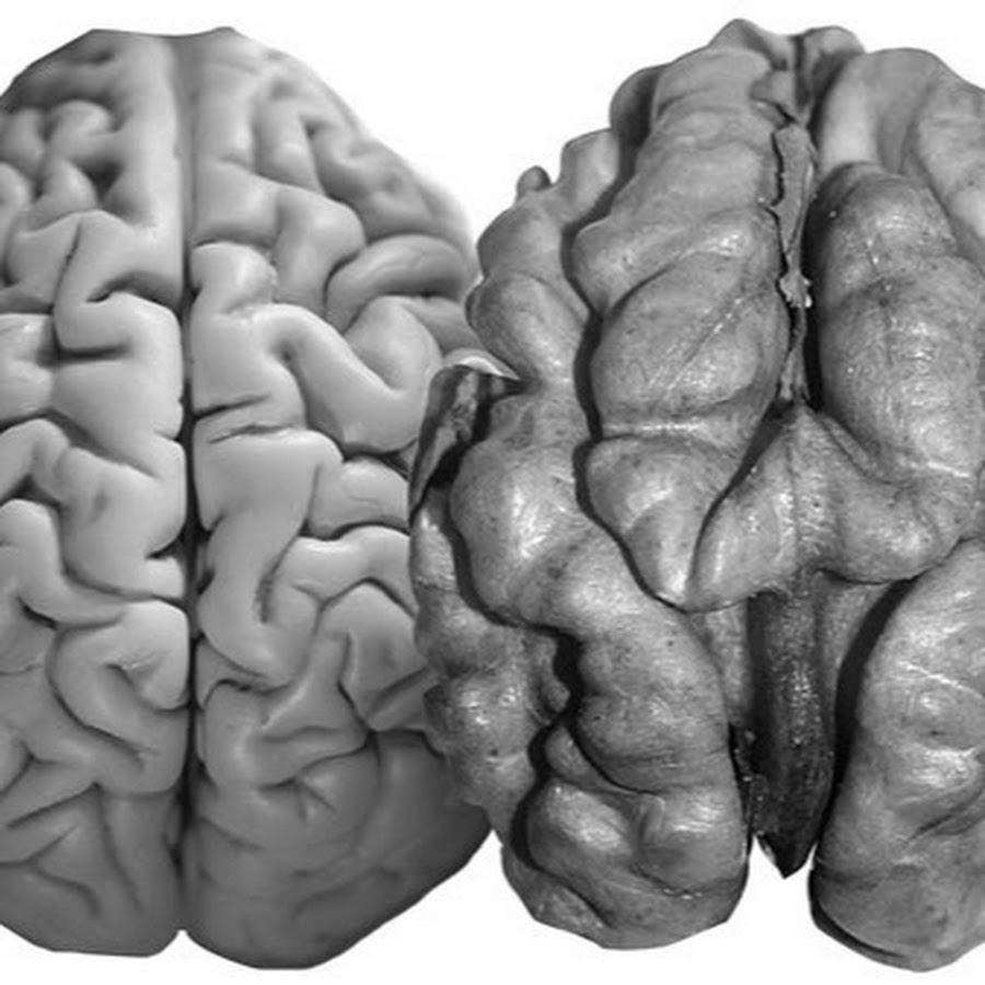 Грецкий орех и мозг картинка