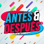 Antes & Después