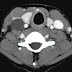 Barton Branstetter (ENT Imaging Lectures)