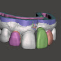 The 3D Dentist - Michael D Scherer, DMD, MS
