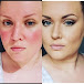 RedBlend Rosacea