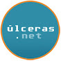 ULCERAS NET