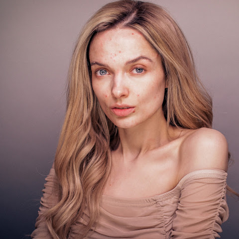 mypaleskinblog