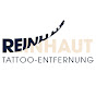 REINHAUT TATTOO-ENTFERNUNG