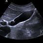 AG Sonographie Charité