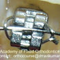 Academy Of Fixed Orthodontics