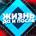 logo Жизнь до и после