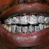 THE GOLD TEETH KINGZ