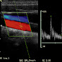 US Doppler Vascular