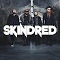 Skindred - Topic