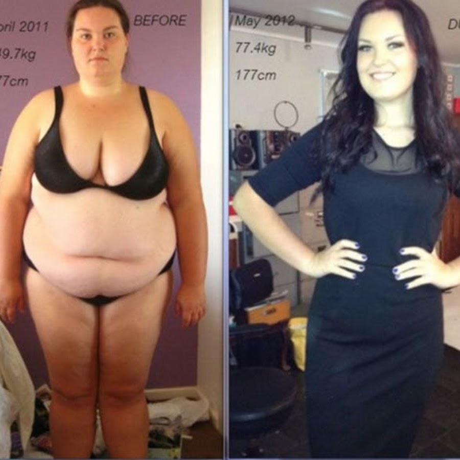 Она сильно похудела. Похудение до и после. Похудение до и после фото. До и после похудения девушки.