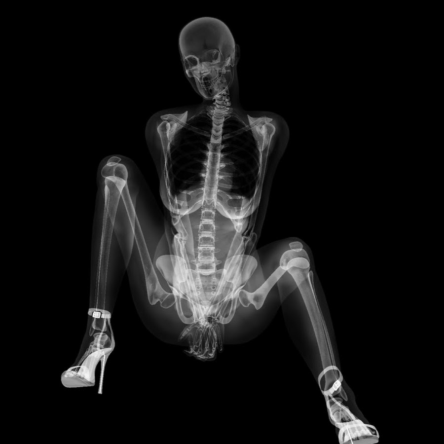 Фото скелета девушек. Рентген ноутбука. Рентген одежды. Рентгеновские снимки в оцифрованном виде.