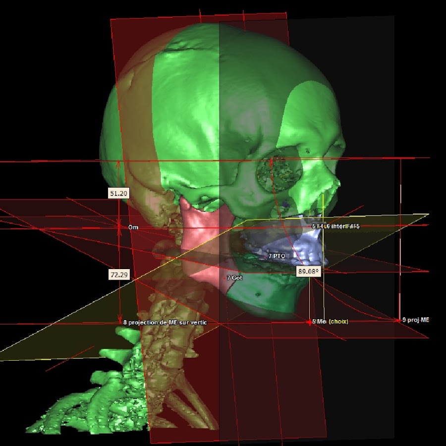 al5grjwrxkwn3dty-efiuehqu4gl2o-3dskl7odhje98-s900-c-k-c0x00ffffff-no-rj