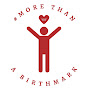 More Than A Birthmark - @morethanabirthmark4832 YouTube Profile Photo