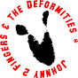 JOHNNY 2 FINGERS & THE DEFORMITIES - @Johnny2Fingers00 YouTube Profile Photo