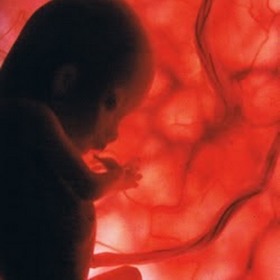 Токсикоз на 12 неделе. Плод на 12 неделе беременности. Малыш на 12 неделе беременности. Зародыш 12 недель беременности. 12 Недель беременности фото плода.