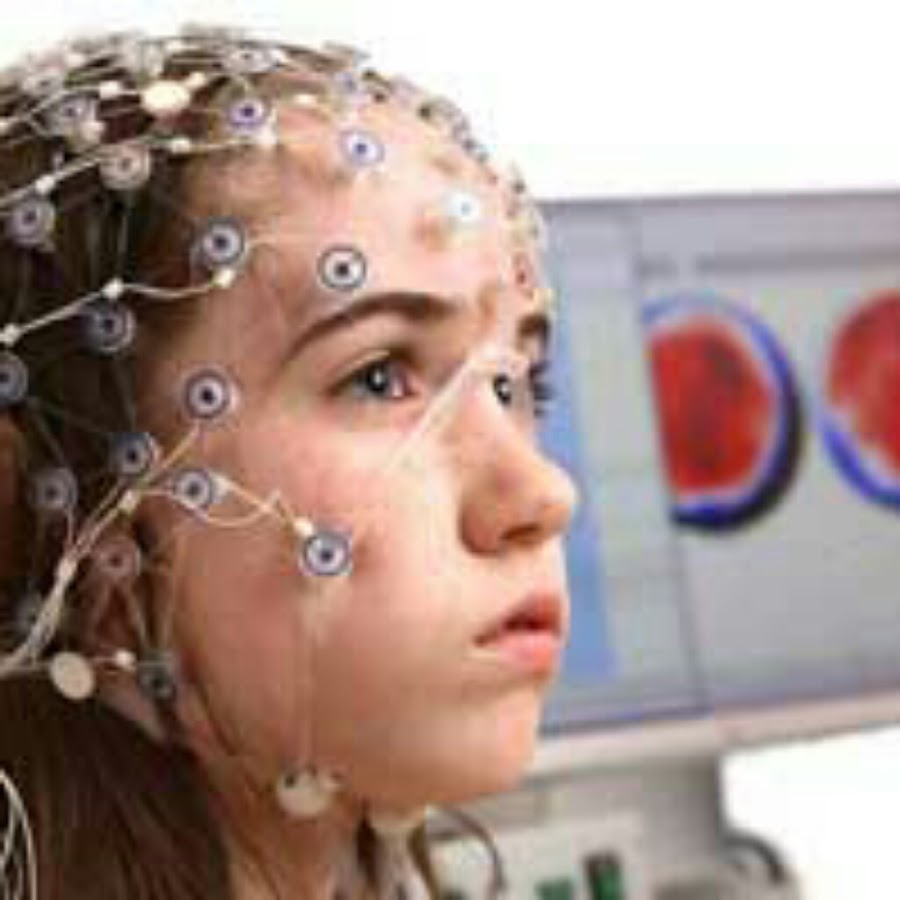 Brain 106. Электроэнцефалография. РЭГ И ЭЭГ. ЭЭГ головного мозга. ЭЭГ головы.