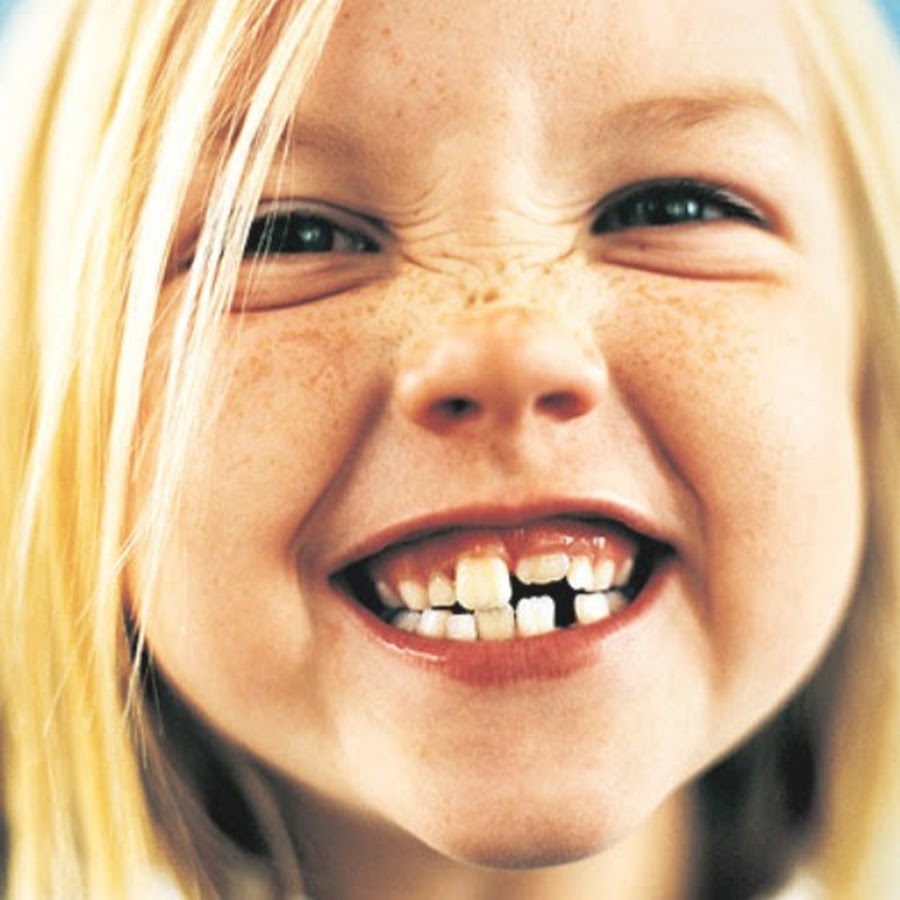 гнилые зубы у детей фото