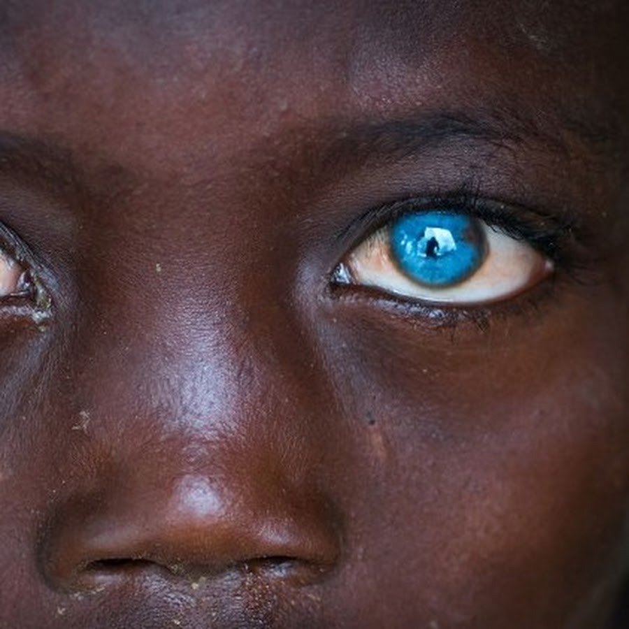 черные глаза фото у людей