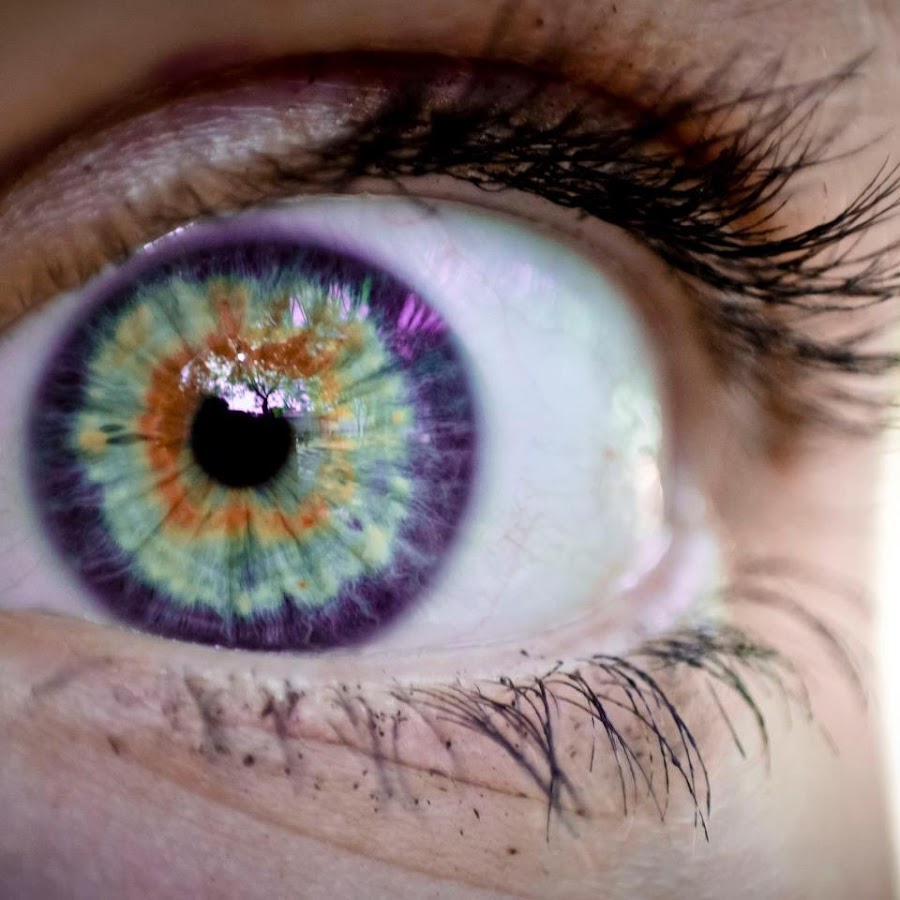 Экзотические глаза. Радужная оболочка гетерохромия. Фиолетовая гетерохромия. Кольцевая гетерохромия глаз. Гетерохромия Радужки глаз.