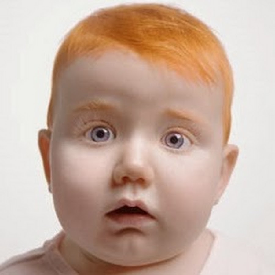 Родилась с рыжими волосами
